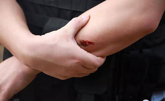 热点：民警执法遭两百人追打 美女网红商场内遇害